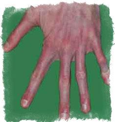 Толстые, длинные или кривые пальцы на руках — узнаем по ним характер